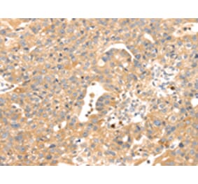 Immunohistochemistry - S100A12 Antibody from Signalway Antibody (42745) - Antibodies.com