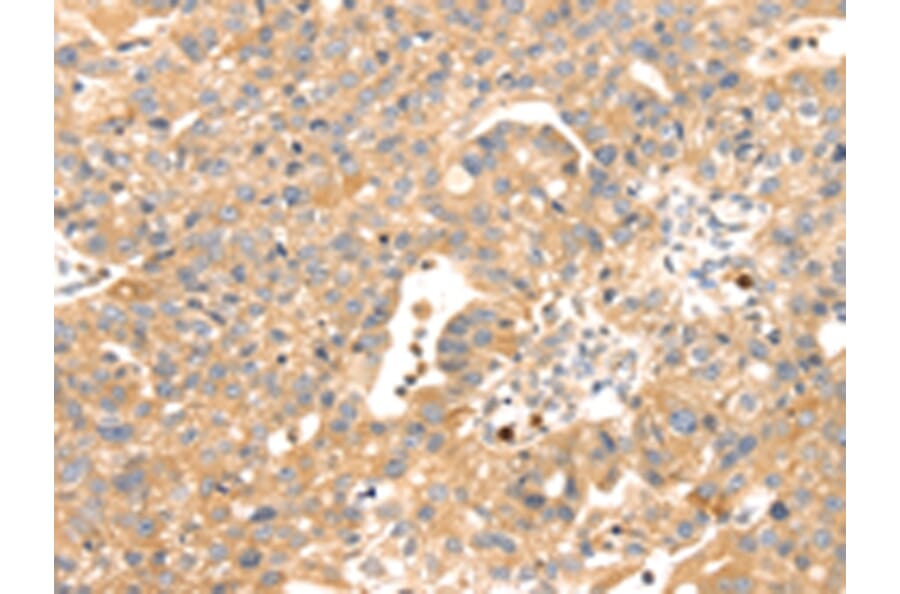 Immunohistochemistry - S100A12 Antibody from Signalway Antibody (42745) - Antibodies.com