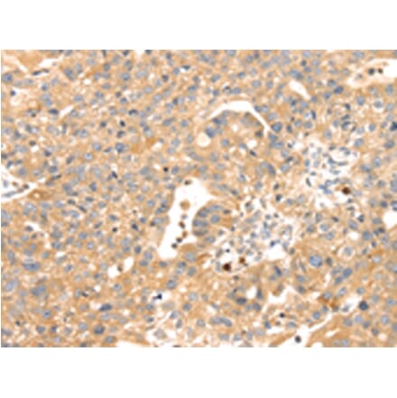 Immunohistochemistry - S100A12 Antibody from Signalway Antibody (42745) - Antibodies.com