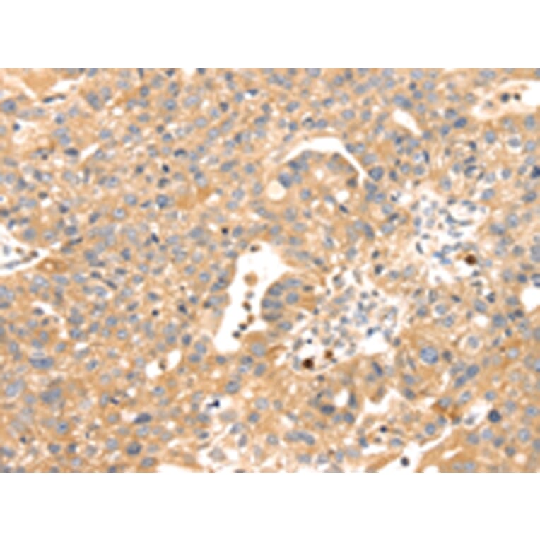 Immunohistochemistry - S100A12 Antibody from Signalway Antibody (42745) - Antibodies.com