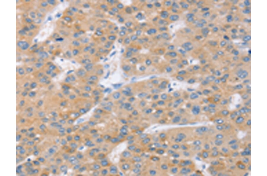 Immunohistochemistry - SLC27A2 Antibody from Signalway Antibody (42758) - Antibodies.com