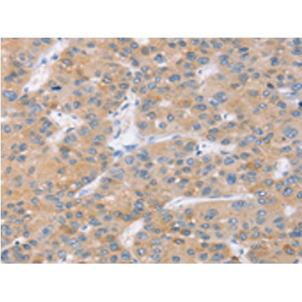 Immunohistochemistry - SLC27A2 Antibody from Signalway Antibody (42758) - Antibodies.com