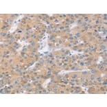 Immunohistochemistry - SLC27A2 Antibody from Signalway Antibody (42758) - Antibodies.com