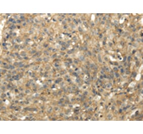 Immunohistochemistry - TACSTD2 Antibody from Signalway Antibody (42791) - Antibodies.com