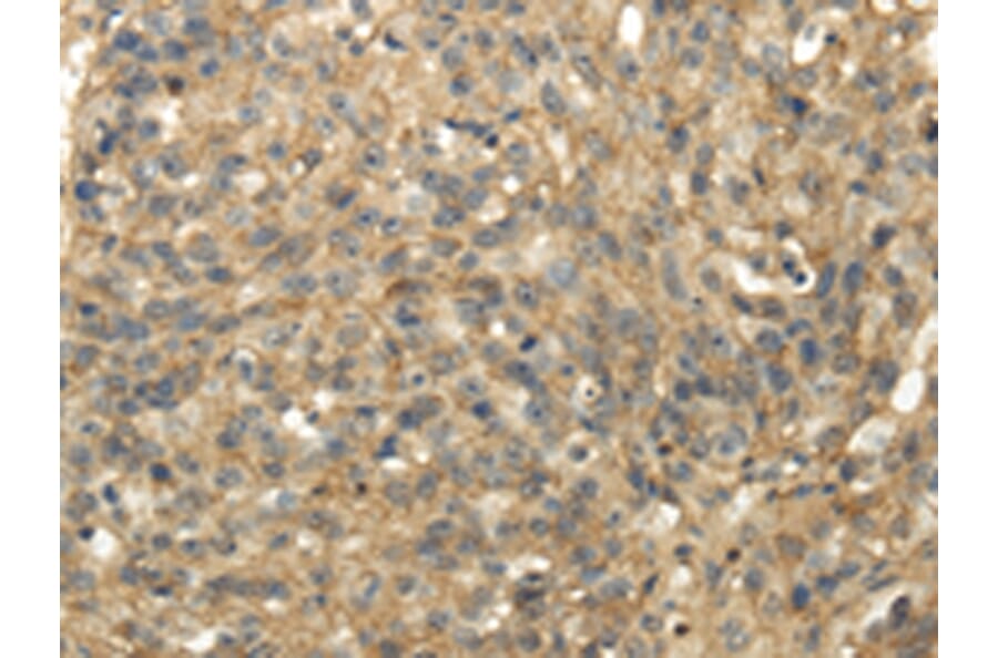 Immunohistochemistry - TACSTD2 Antibody from Signalway Antibody (42791) - Antibodies.com