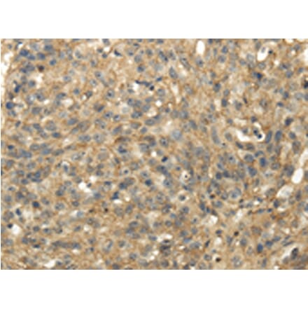Immunohistochemistry - TACSTD2 Antibody from Signalway Antibody (42791) - Antibodies.com