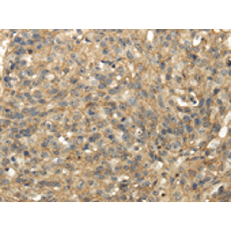 Immunohistochemistry - TACSTD2 Antibody from Signalway Antibody (42791) - Antibodies.com