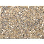 Immunohistochemistry - TACSTD2 Antibody from Signalway Antibody (42791) - Antibodies.com