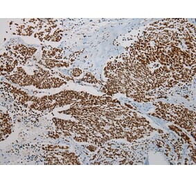 Immunohistochemistry - TRPC4AP Antibody from Signalway Antibody (42792) - Antibodies.com