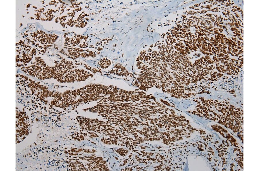 Immunohistochemistry - TRPC4AP Antibody from Signalway Antibody (42792) - Antibodies.com