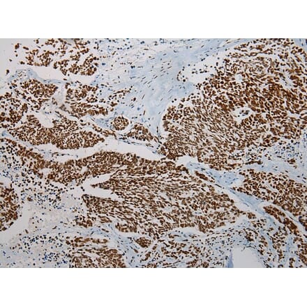 Immunohistochemistry - TRPC4AP Antibody from Signalway Antibody (42792) - Antibodies.com