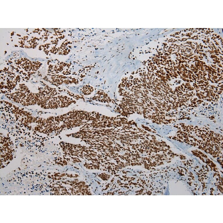 Immunohistochemistry - TRPC4AP Antibody from Signalway Antibody (42792) - Antibodies.com