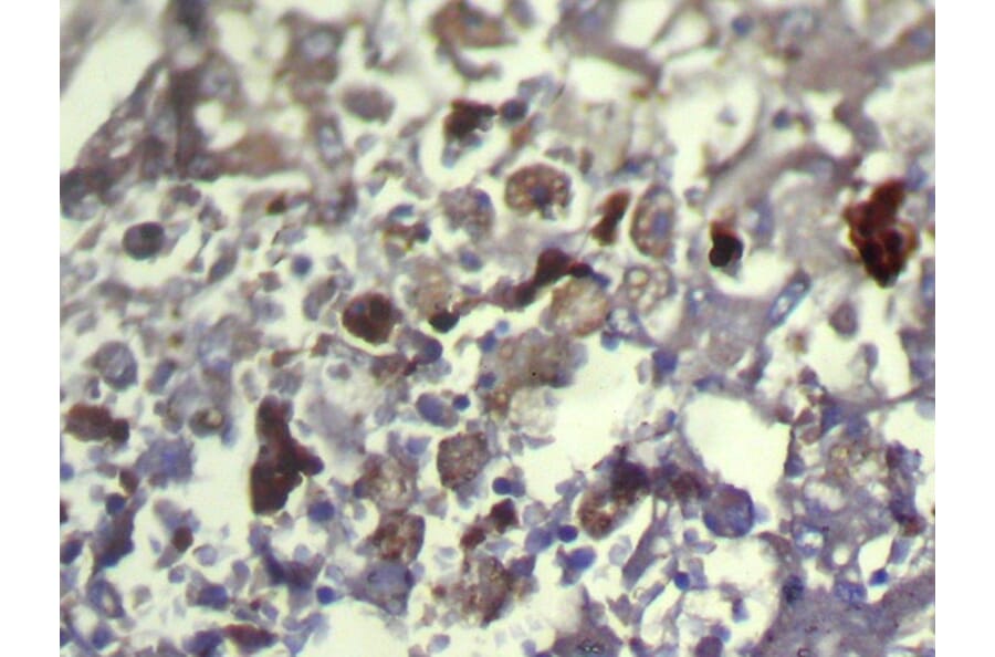 Immunohistochemistry - TXNDC11 Antibody from Signalway Antibody (42799) - Antibodies.com