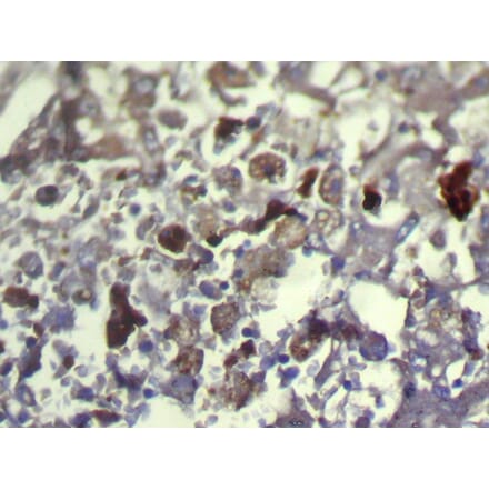 Immunohistochemistry - TXNDC11 Antibody from Signalway Antibody (42799) - Antibodies.com