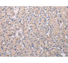 Immunohistochemistry - ZDHHC20 Antibody from Signalway Antibody (42868) - Antibodies.com