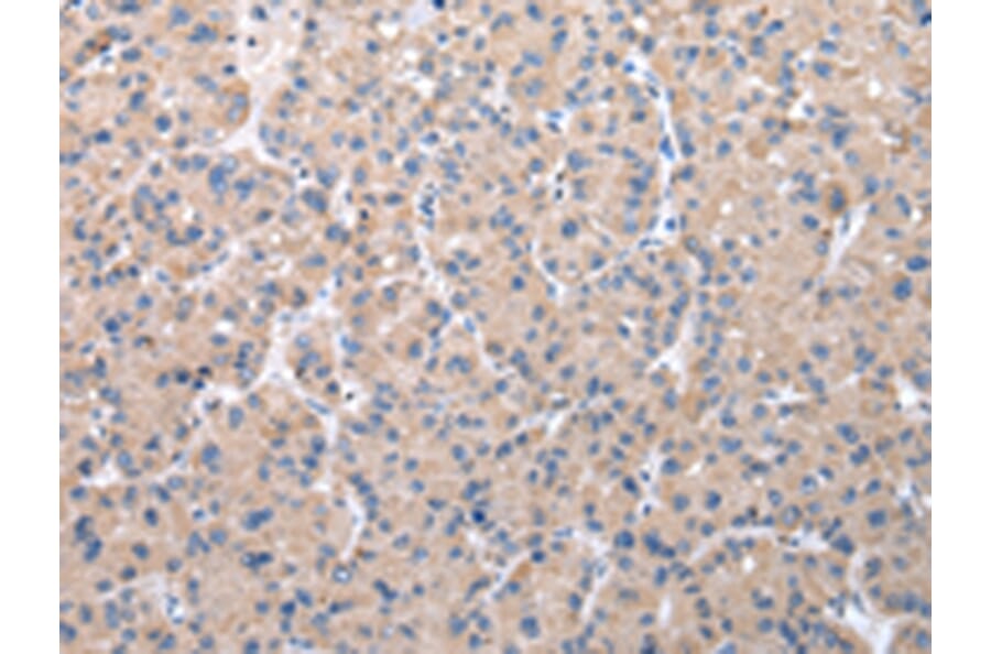 Immunohistochemistry - ZDHHC20 Antibody from Signalway Antibody (42868) - Antibodies.com