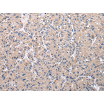 Immunohistochemistry - ZDHHC20 Antibody from Signalway Antibody (42868) - Antibodies.com