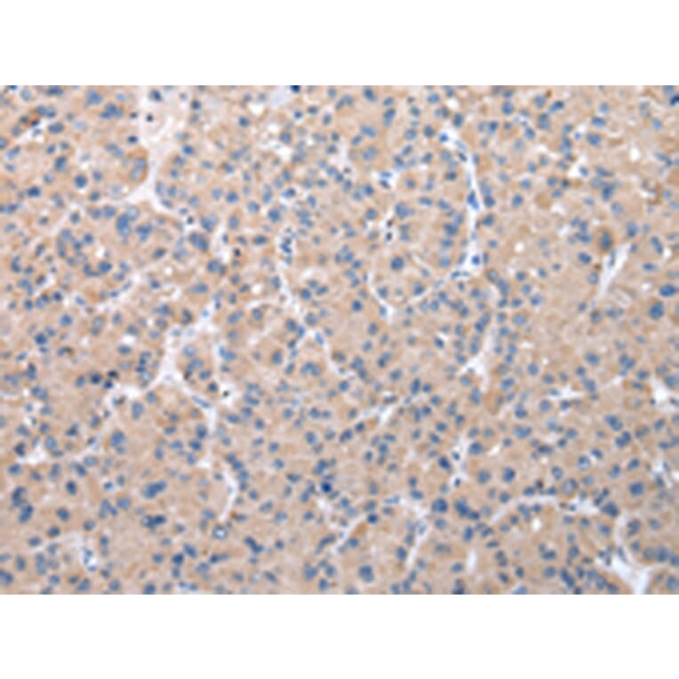 Immunohistochemistry - ZDHHC20 Antibody from Signalway Antibody (42868) - Antibodies.com
