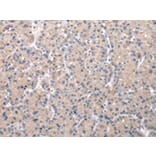 Immunohistochemistry - ZDHHC20 Antibody from Signalway Antibody (42868) - Antibodies.com