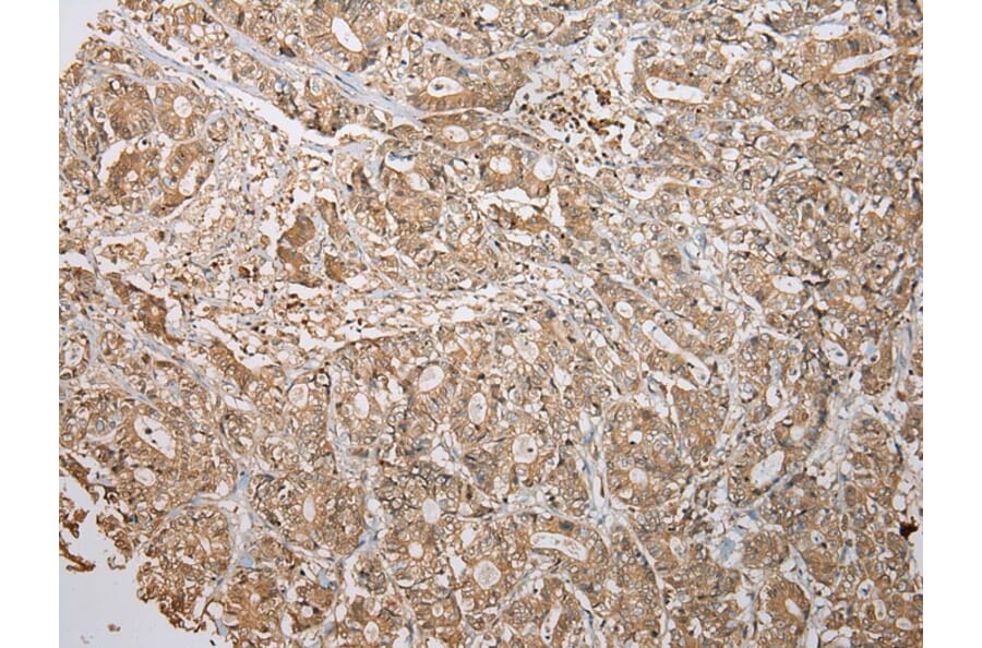 Immunohistochemistry - ATXN7L3 Antibody from Signalway Antibody (42911) - Antibodies.com