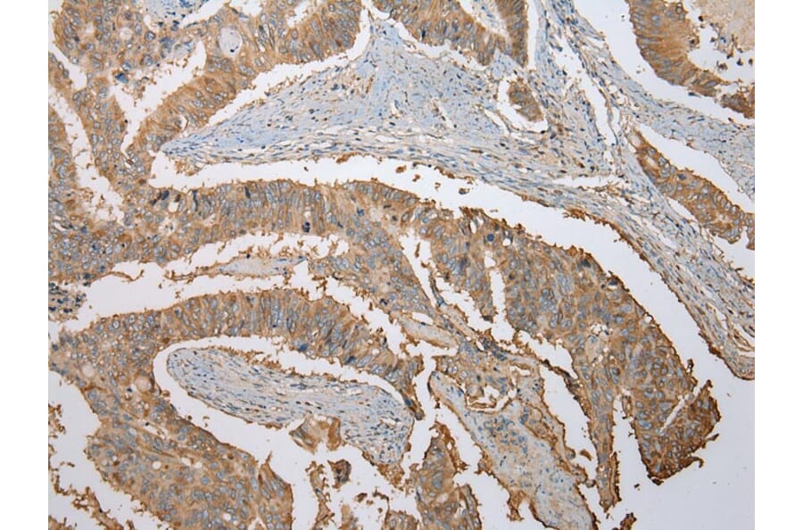 Immunohistochemistry - ATXN7L3 Antibody from Signalway Antibody (42911) - Antibodies.com