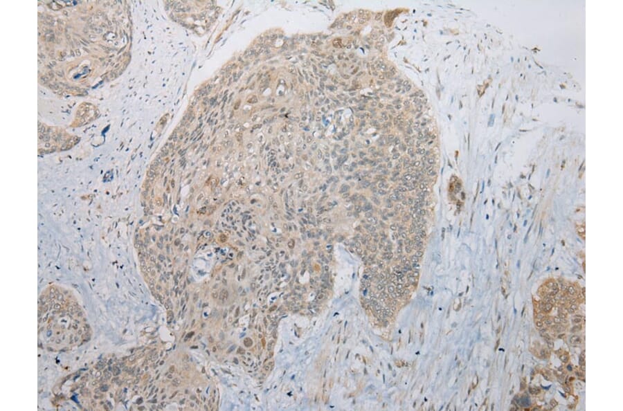 Immunohistochemistry - B4GALT5 Antibody from Signalway Antibody (42914) - Antibodies.com