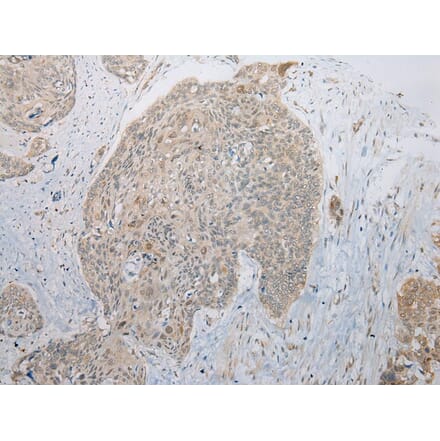 Immunohistochemistry - B4GALT5 Antibody from Signalway Antibody (42914) - Antibodies.com