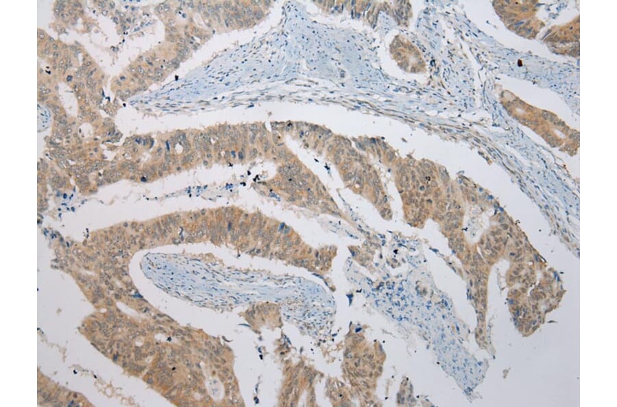 Immunohistochemistry - B4GALT5 Antibody from Signalway Antibody (42914) - Antibodies.com