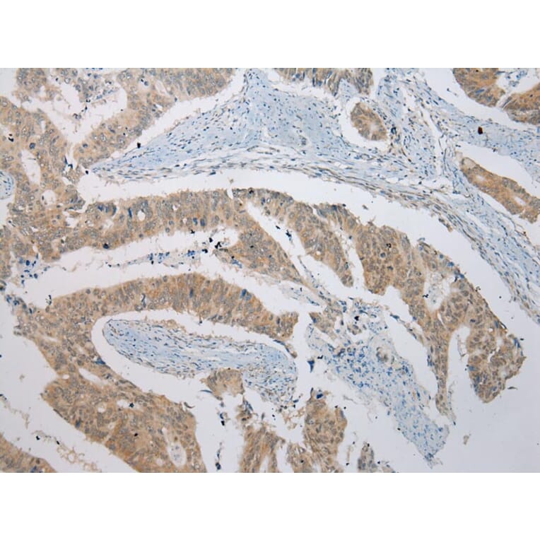 Immunohistochemistry - B4GALT5 Antibody from Signalway Antibody (42914) - Antibodies.com