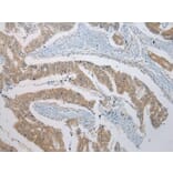 Immunohistochemistry - B4GALT5 Antibody from Signalway Antibody (42914) - Antibodies.com