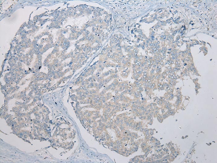 Immunohistochemical analysis of paraffin-embedded Human Liver tissue using #42928 at dilution 1/200,