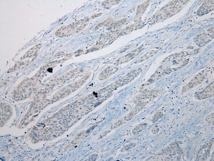 Immunohistochemical analysis of paraffin-embedded Human Oesophagus tissue using #42928 at dilution 1/200,