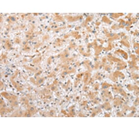 Immunohistochemistry - C1QTNF3 Antibody from Signalway Antibody (42952) - Antibodies.com