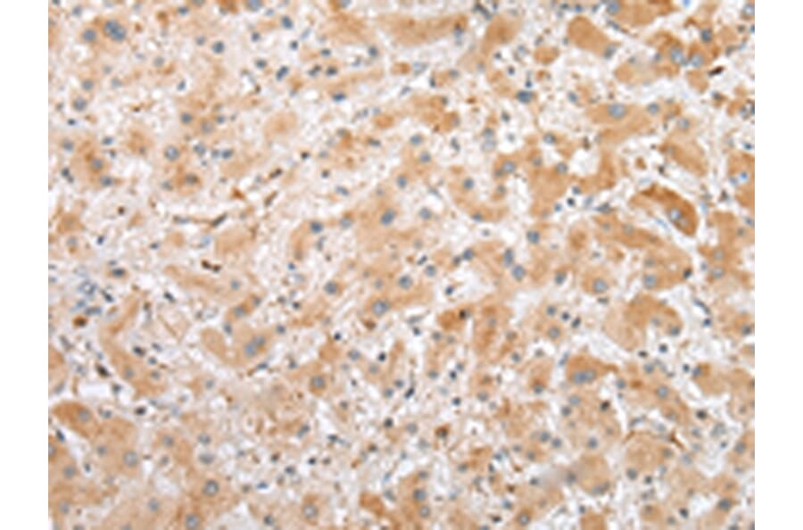 Immunohistochemistry - C1QTNF3 Antibody from Signalway Antibody (42952) - Antibodies.com