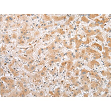 Immunohistochemistry - C1QTNF3 Antibody from Signalway Antibody (42952) - Antibodies.com