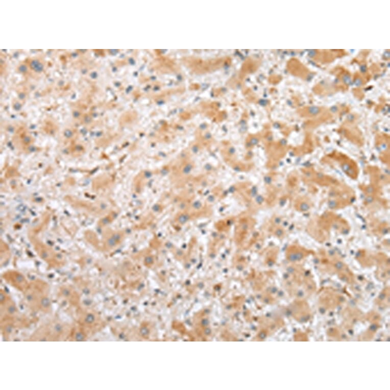 Immunohistochemistry - C1QTNF3 Antibody from Signalway Antibody (42952) - Antibodies.com