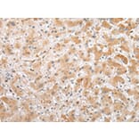 Immunohistochemistry - C1QTNF3 Antibody from Signalway Antibody (42952) - Antibodies.com