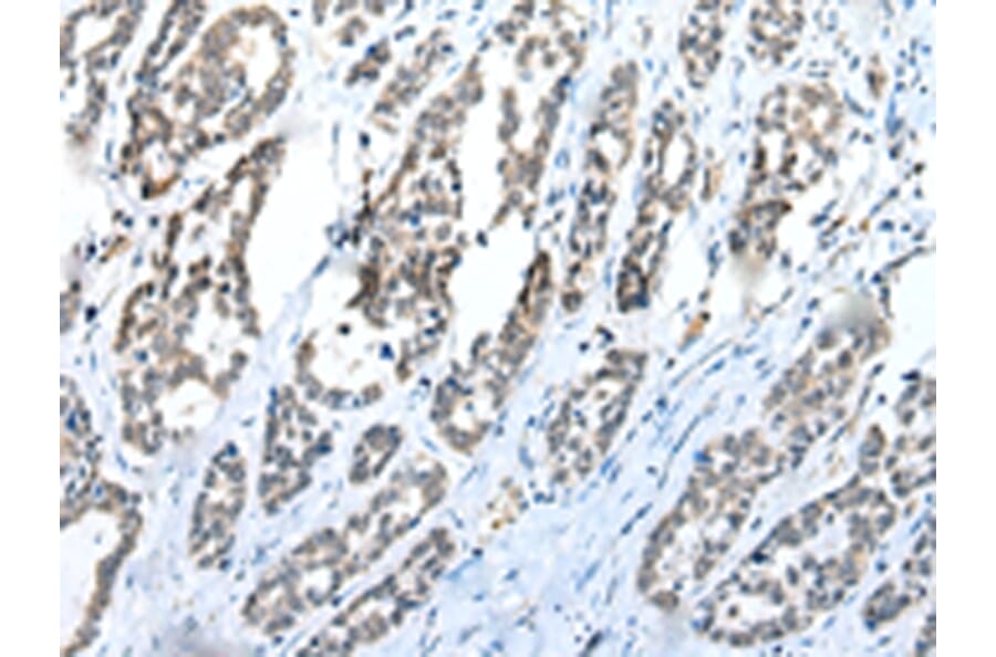 Immunohistochemistry - C1QTNF3 Antibody from Signalway Antibody (42952) - Antibodies.com