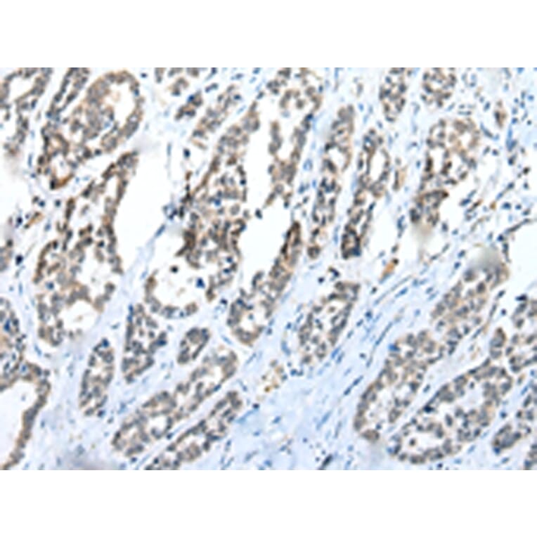 Immunohistochemistry - C1QTNF3 Antibody from Signalway Antibody (42952) - Antibodies.com