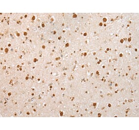 Immunohistochemistry - KHDRBS3 Antibody from Signalway Antibody (42967) - Antibodies.com