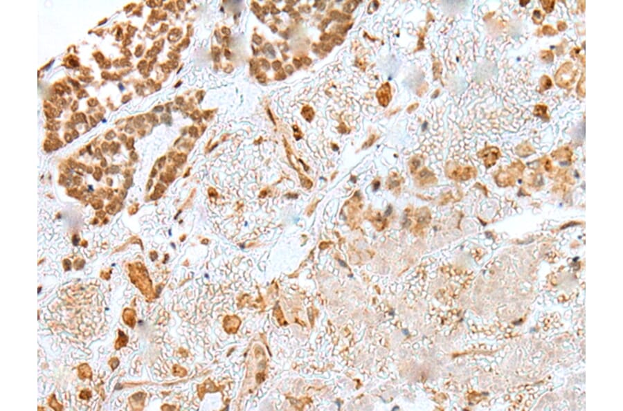 Immunohistochemistry - KHDRBS3 Antibody from Signalway Antibody (42967) - Antibodies.com