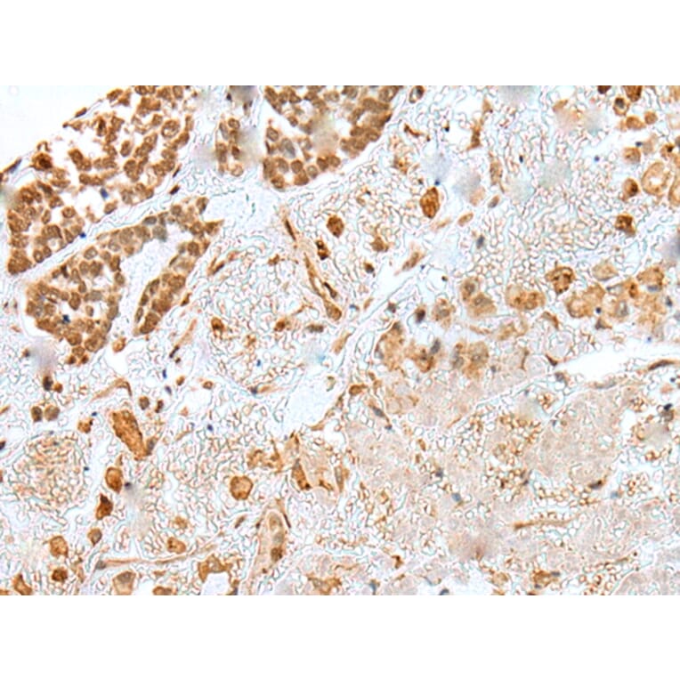 Immunohistochemistry - KHDRBS3 Antibody from Signalway Antibody (42967) - Antibodies.com