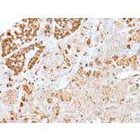 Immunohistochemistry - KHDRBS3 Antibody from Signalway Antibody (42967) - Antibodies.com
