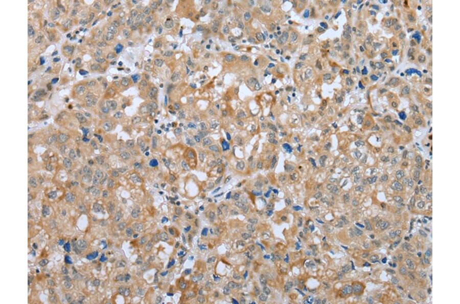 Immunohistochemistry - PLA2G4D Antibody from Signalway Antibody (42975) - Antibodies.com