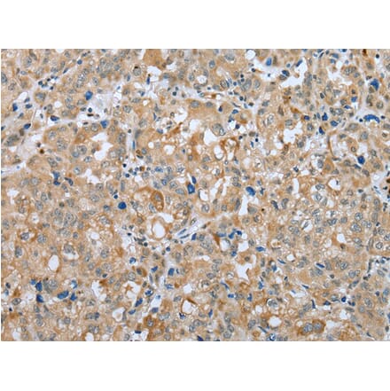 Immunohistochemistry - PLA2G4D Antibody from Signalway Antibody (42975) - Antibodies.com
