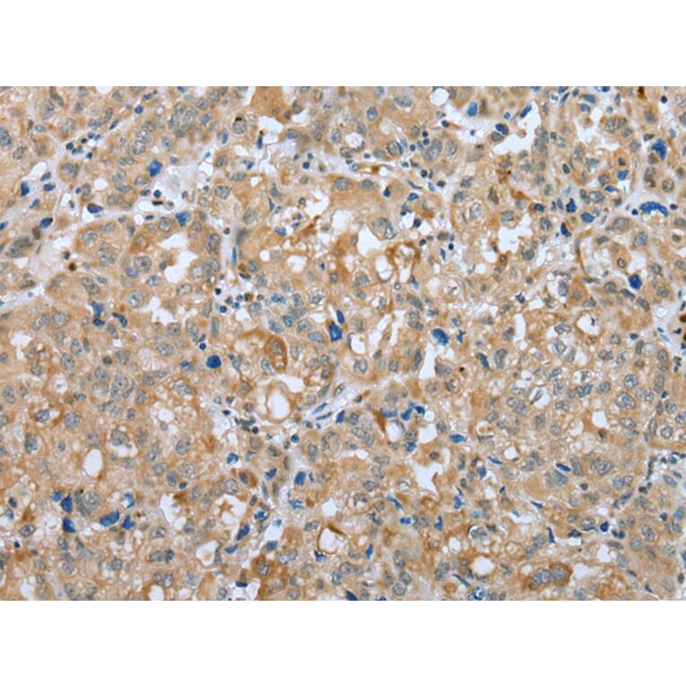 Immunohistochemistry - PLA2G4D Antibody from Signalway Antibody (42975) - Antibodies.com