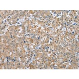 Immunohistochemistry - PLA2G4D Antibody from Signalway Antibody (42975) - Antibodies.com