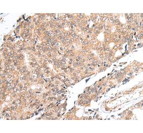 Immunohistochemistry - PRELID1 Antibody from Signalway Antibody (42978) - Antibodies.com