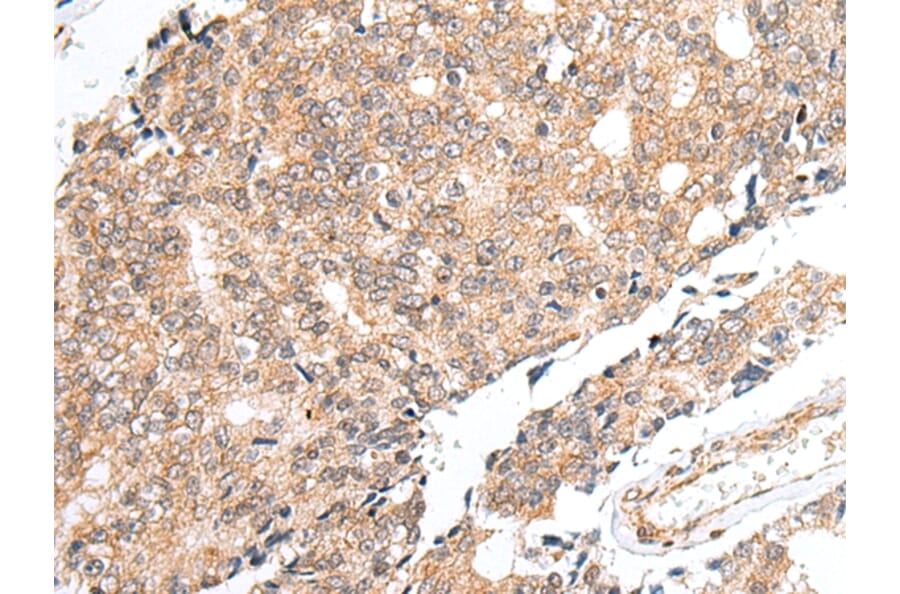 Immunohistochemistry - PRELID1 Antibody from Signalway Antibody (42978) - Antibodies.com