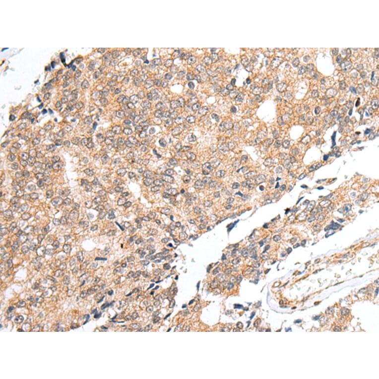 Immunohistochemistry - PRELID1 Antibody from Signalway Antibody (42978) - Antibodies.com